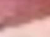 link thumbnail