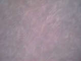 link thumbnail