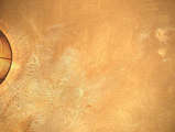 link thumbnail